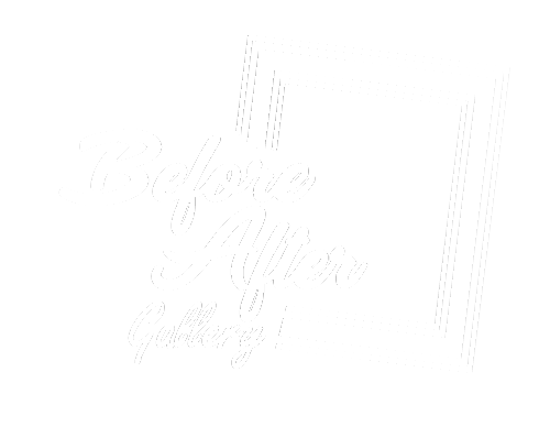 Before After Gallery